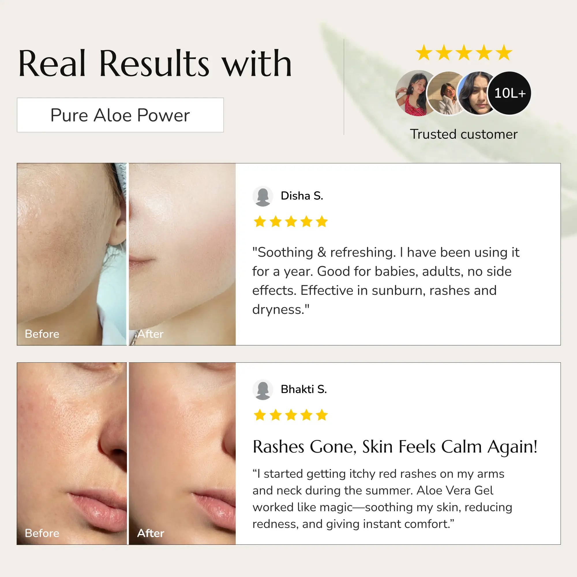 Greenleaf Aloe Vera Skin Gel
