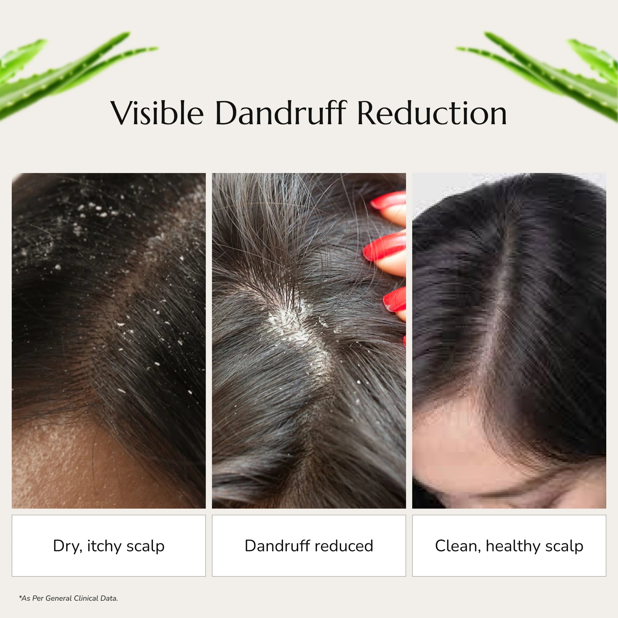 Greenleaf Anti Dandruff Gel
