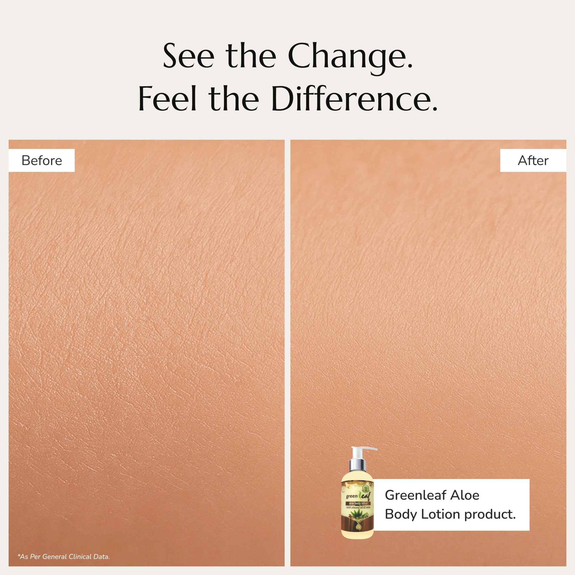 Greenleaf Aloe Body Lotion