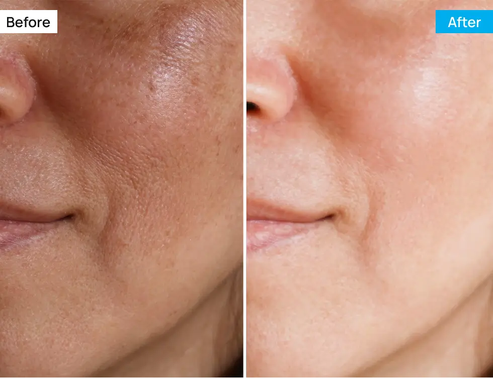 Before After Image