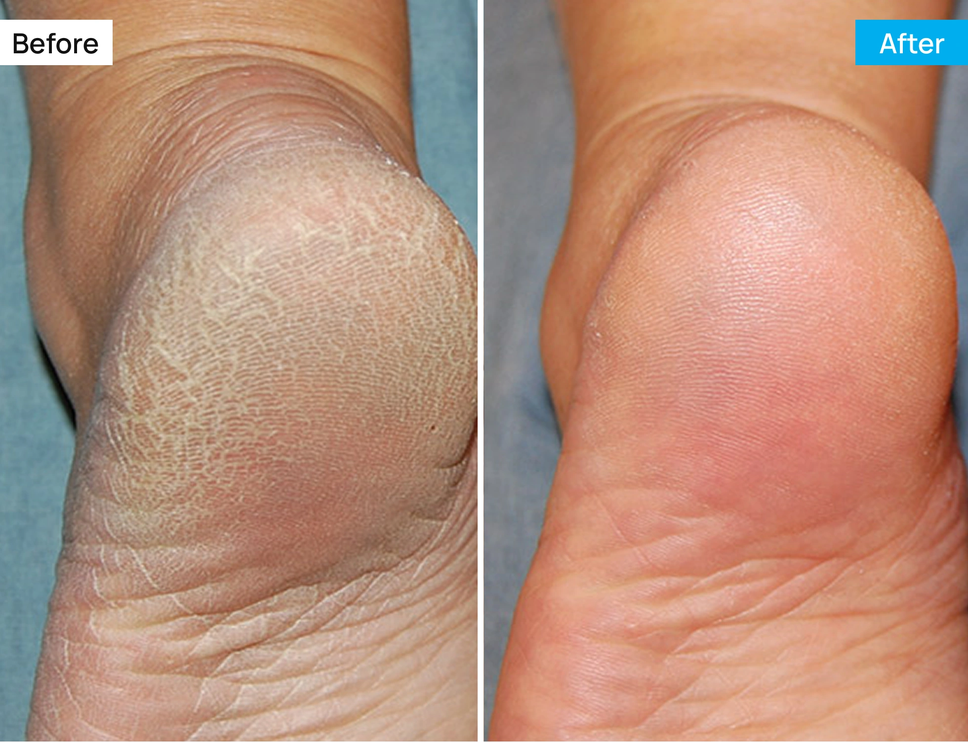 Before After Image