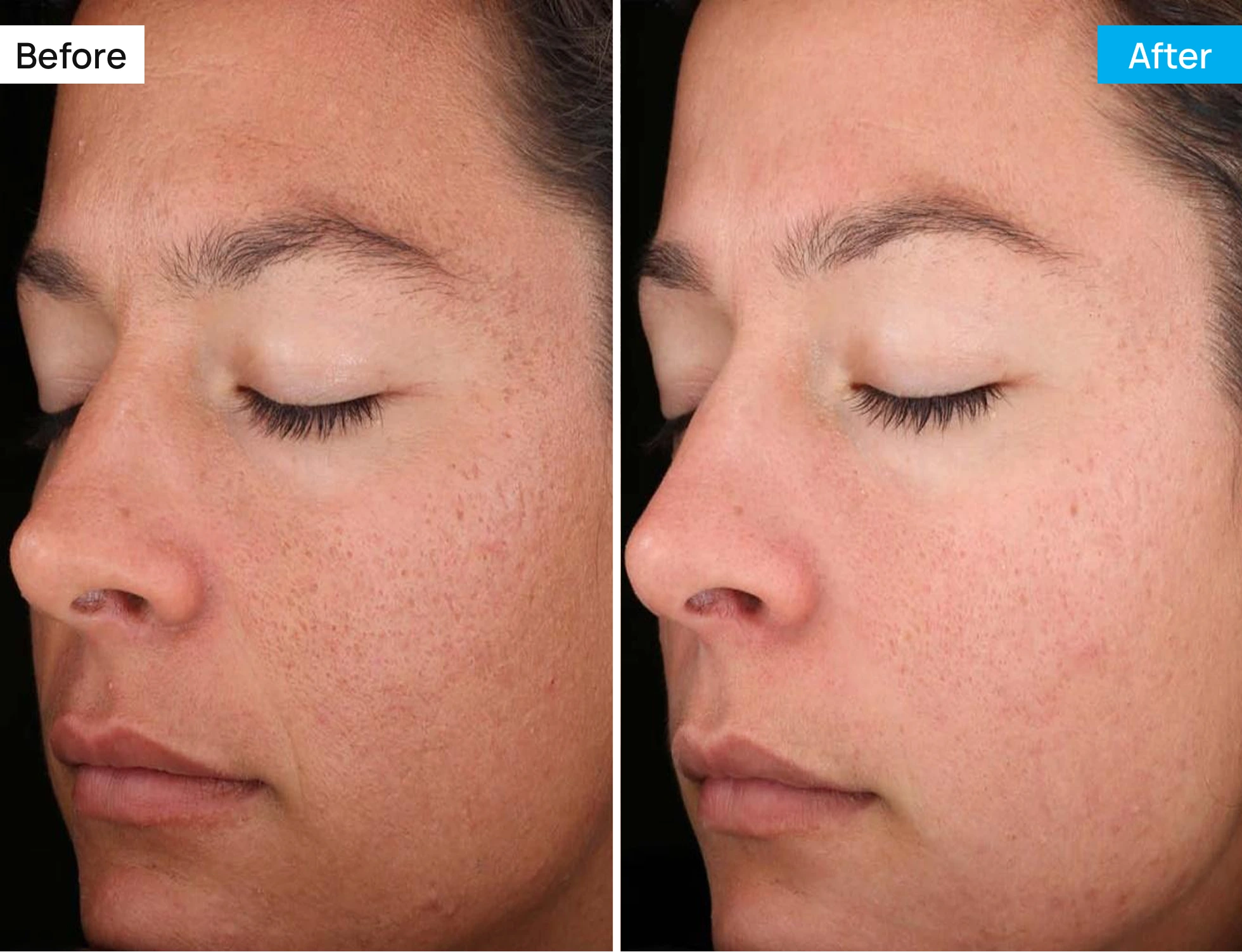 Before After Image