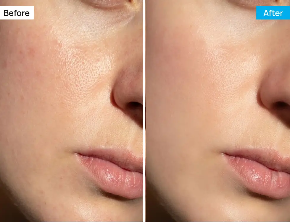 Before After Image