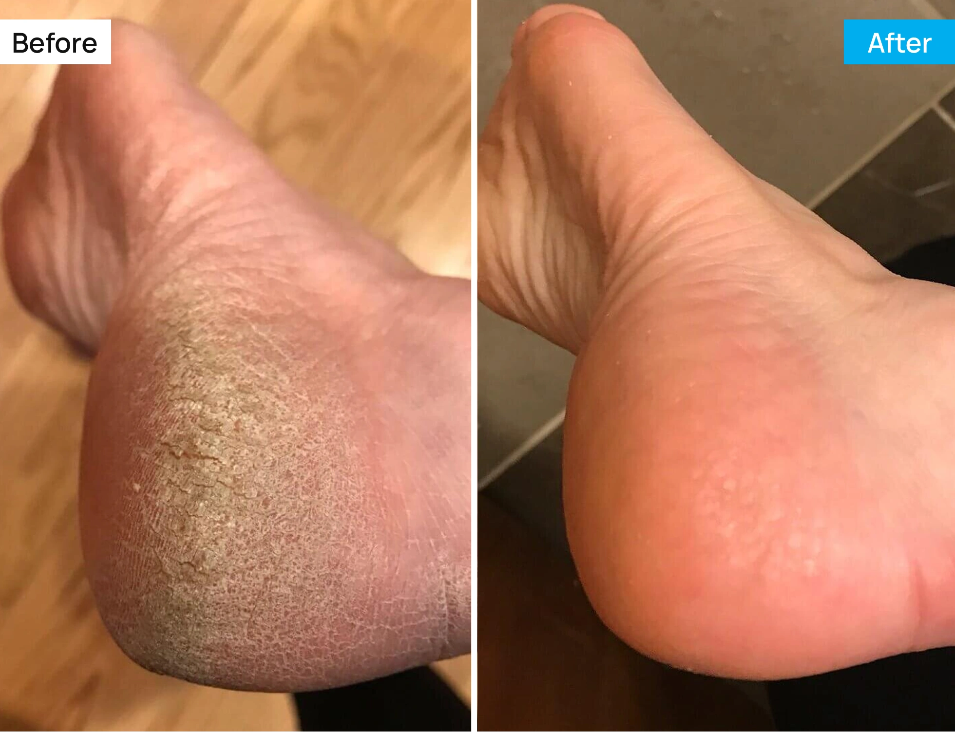 Before After Image