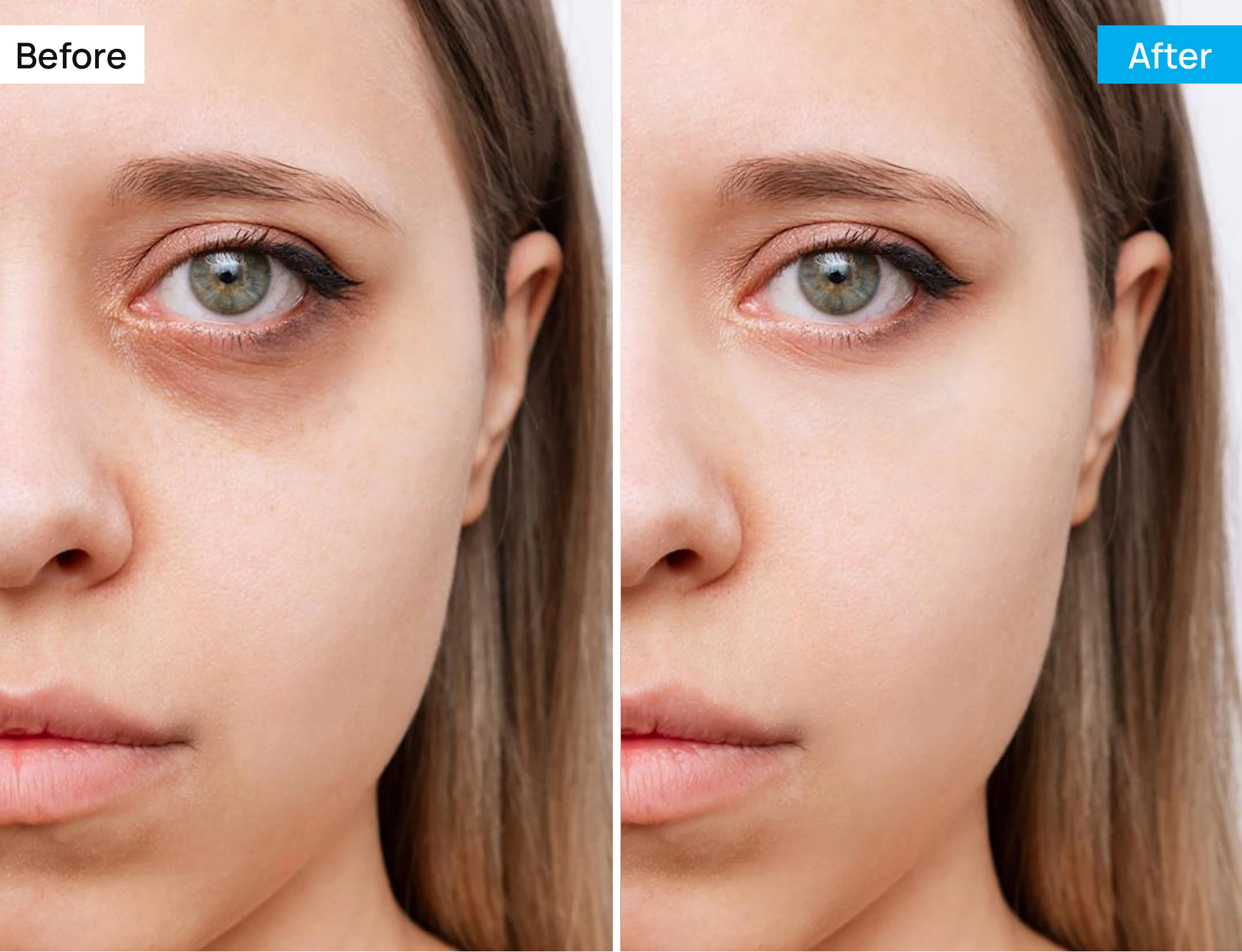 Before After Image