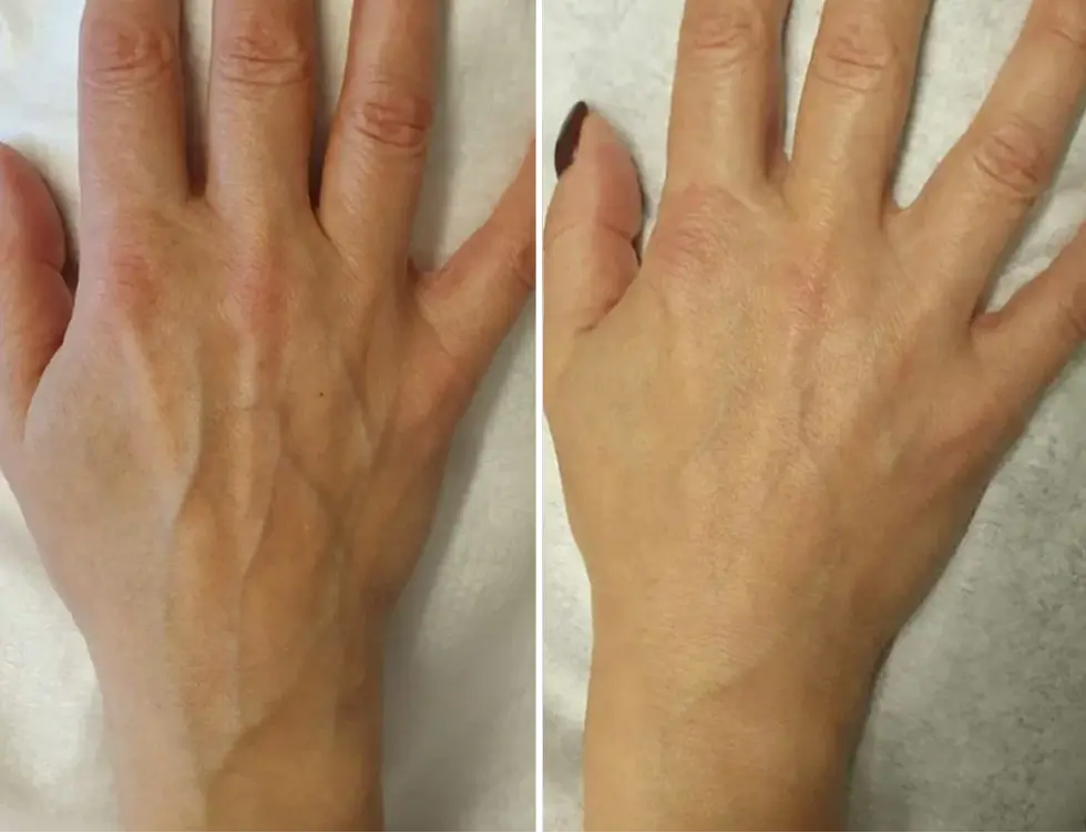 Before After Image