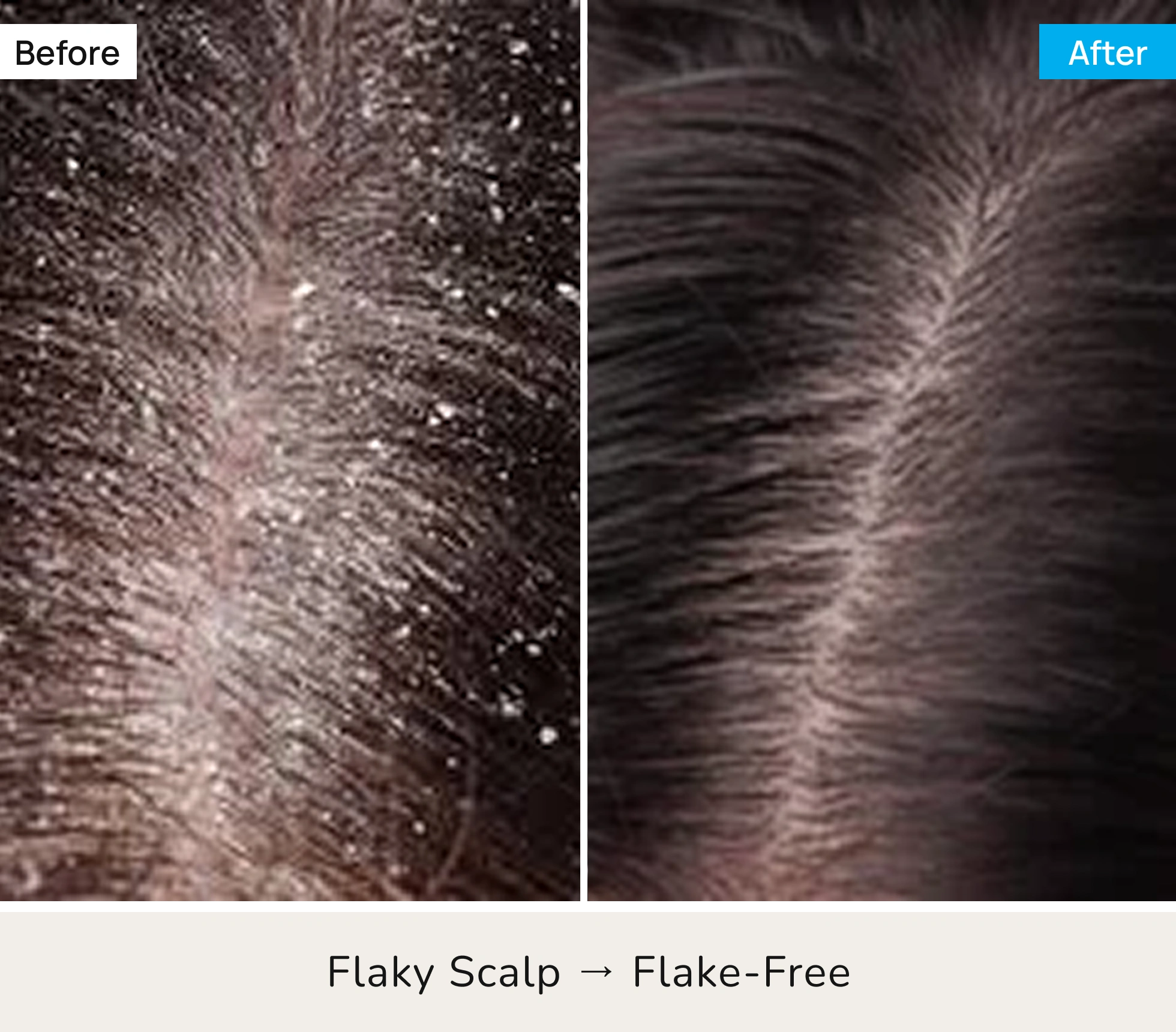 Before After Image