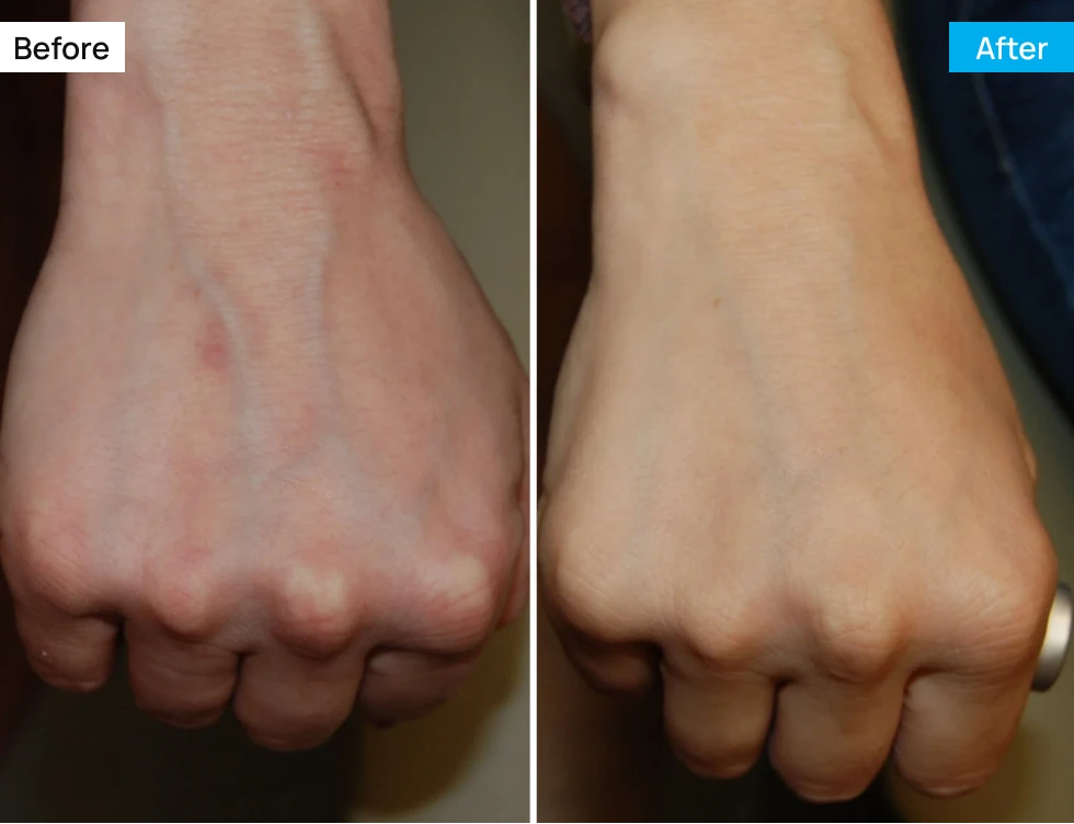 Before After Image