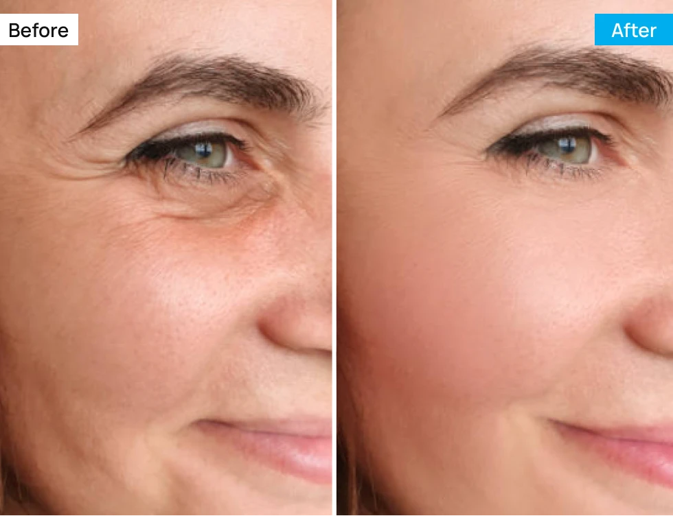 Before After Image