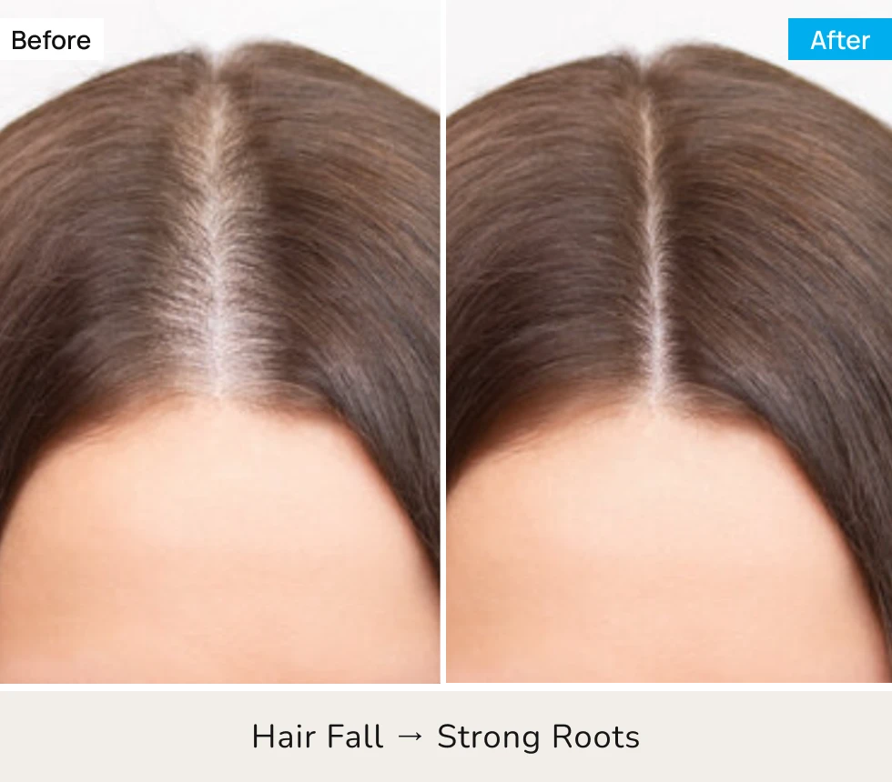 Before After Image