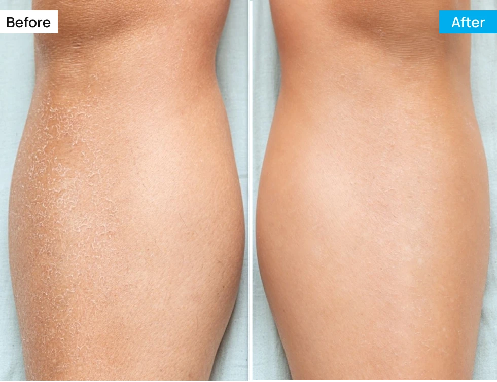 Before After Image
